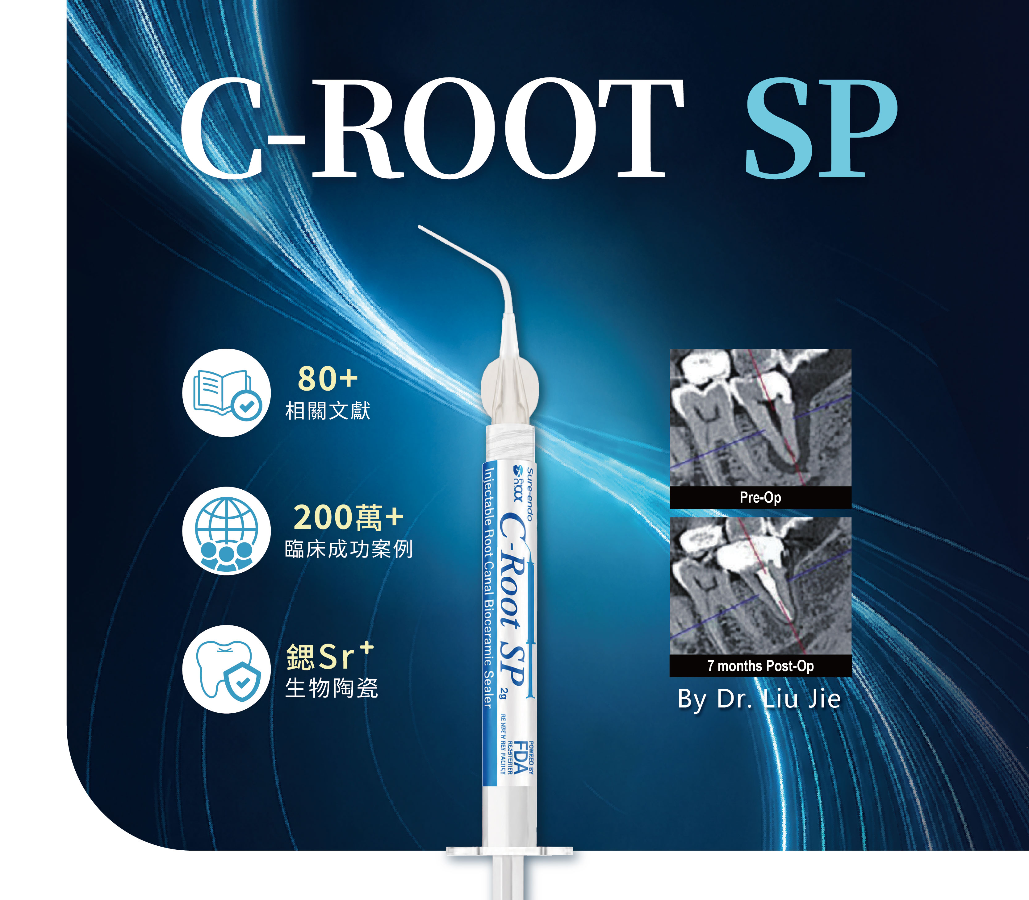 【2026聯揚新品 🎖️𝑪-𝑹𝒐𝒐𝒕 𝑺𝑷 生物陶瓷充填材料 好評登場✨】